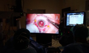 El Hospital del Henares usa la cirugía 3D en las operaciones oftalmológicas