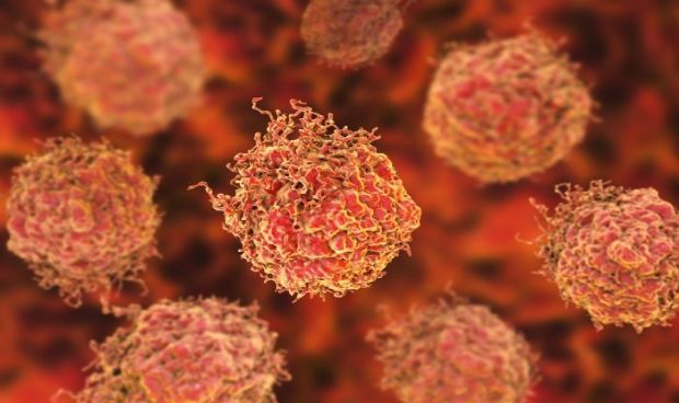 Un nuevo marcador genético ayuda a detectar cáncer de próstata agresivo