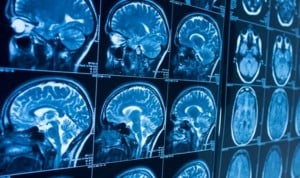 El oxígeno abre la puerta a una mejora de los pacientes con lesión cerebral