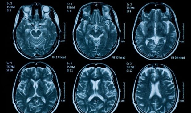 El paciente neurocrítico suma una nueva guía para mejorar su abordaje