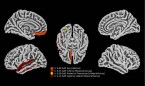 El SARS-CoV-2, capaz de infectar astrocitos y provocar muerte neuronal