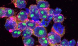 El uso de nanocápsulas de control remoto puede ampliar el efecto de la quimioterapia en células como el linfoma difuso.