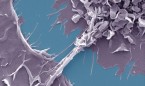 El VIH en presencia de tuberculosis se mueve entre células por nanotubos