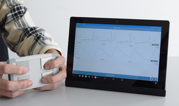 Electrocardiograma en un minuto y a travs de un telfono mvil