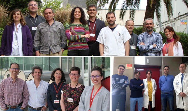 Encuentran un posible biomarcador de aneurisma aórtico abdominal