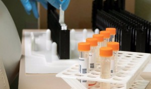 España alcanza los 7.188 casos confirmados de viruela del mono