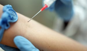 España lidera el mayor estudio sobre tratamiento inyectable para VIH