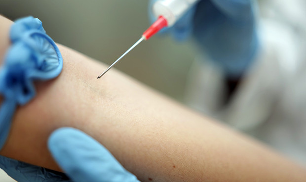 España lidera el mayor estudio sobre tratamiento inyectable para VIH