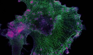 España lidera un método que mejora fármacos oncológicos con nanotecnología