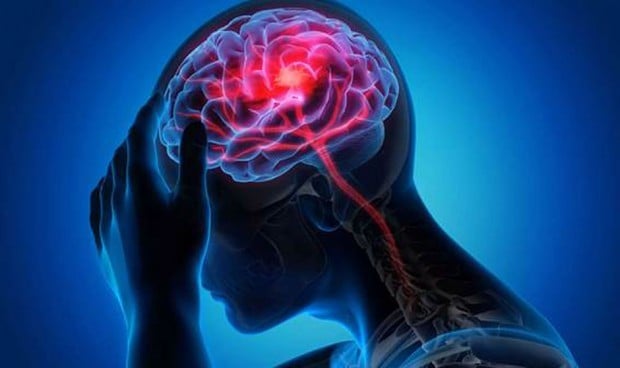 Nuevos criterios para monitorizar el daño cerebral tras un ictus