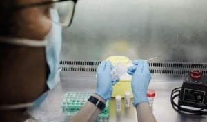 España 'roza' los 200 casos positivos de viruela del mono