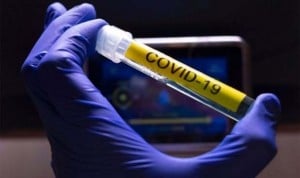 Covid-19: Más del 90% de los contagios producen anticuerpos neutralizantes