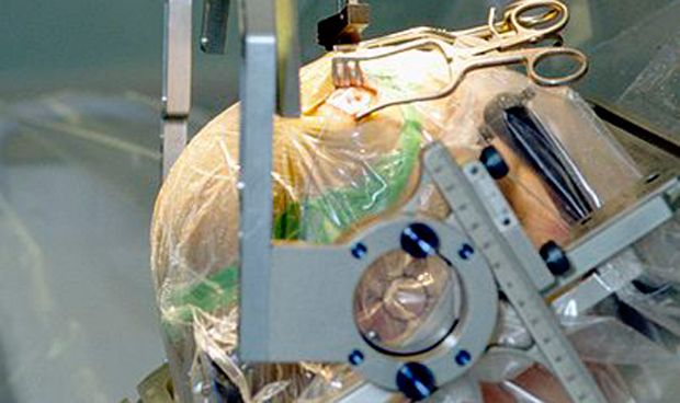 Éxito de la estimulación cerebral no invasiva en pacientes con párkinson