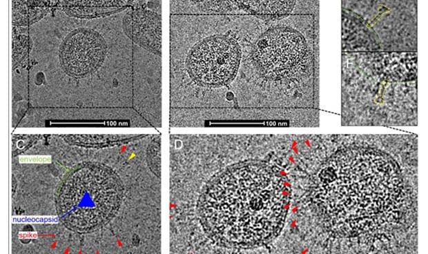 Foto del coronavirus: así es de verdad el SARS-CoV-2