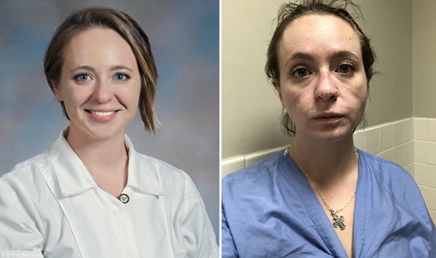 'El antes y el después' de una enfermera Covid: "El virus es devastador"