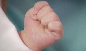 Francia investiga el aumento de nacimientos de bebés sin brazos ni manos