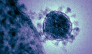 Francia registra la primera muerte por coronavirus en Europa