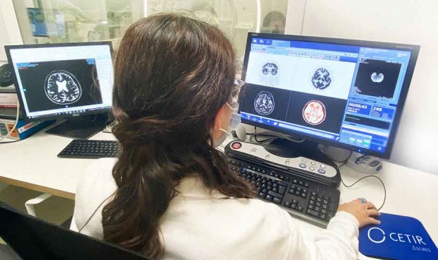 Una investigación impulsada por la Cátedra QUAES-UPF identifica genes protectores frente al Alzheimer que abren la puerta al tratamiento de la enfermedad