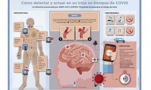 Guía rápida de Enfermería para detectar un ictus de forma temprana