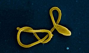 Hallan anticuerpos neutralizantes en la sangre de supervivientes del ébola