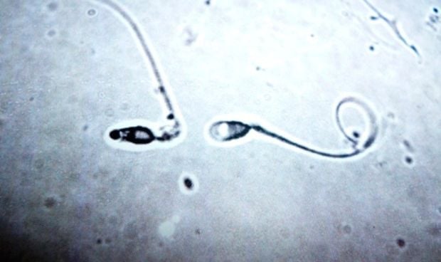 Hallan dos mutaciones en el esperma asociadas a las patologías cutáneas
