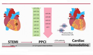 Hallan un posible marcador pronóstico de remodelado cardiaco tras infarto