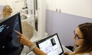HM Hospitales se refuerza con dos nuevos mamógrafos 3D con tomosíntesis