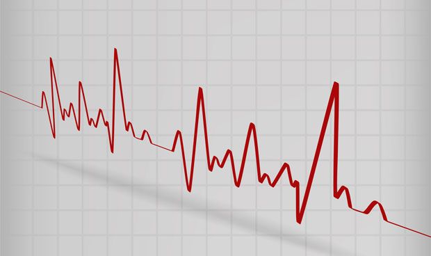 Identificadas nuevas causas de las arritmias cardiacas