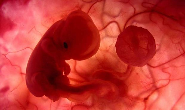 Identifican un biomarcador fetal para pronosticar alteraciones neurolgicas