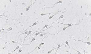 Inesperado efecto de los fármacos tipo Ozempic en la fertilidad masculina