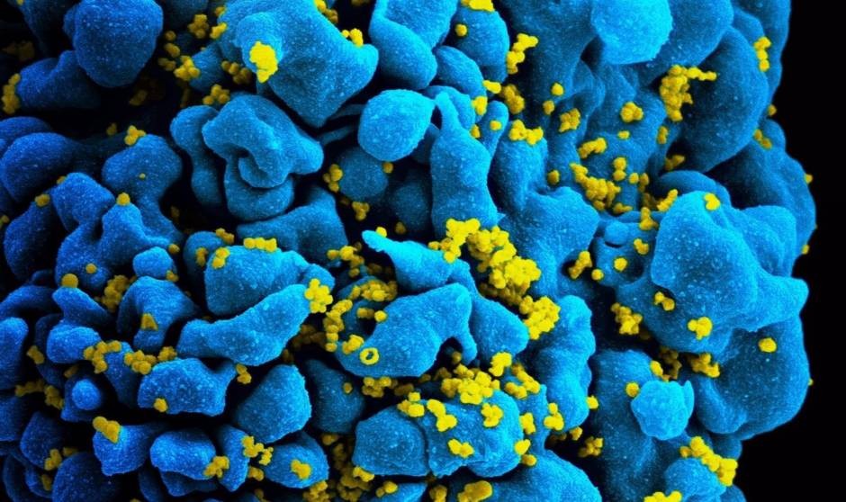 Iniciar los antirretrovirales "lo antes posible", clave para frenar el VIH