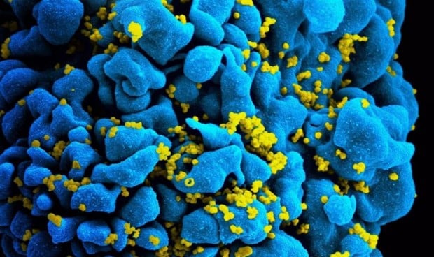 Iniciar los antirretrovirales "lo antes posible", clave para frenar el VIH