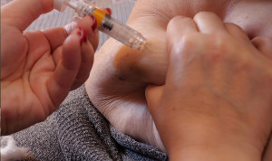 Instrucciones para un shock anafiláctico: Tres pasos "para salvar una vida"