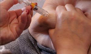  Inyección de adrenalina. El médico David Callejo detalla los síntomas de un shock anafiláctico y cómo utilizar correctamente el inyector de adrenalina para salvar una vida