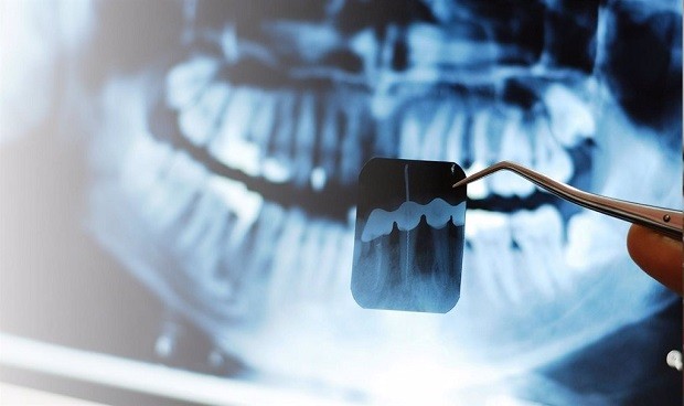 El intrusismo en Odontología, a la baja pero con cambios históricos 