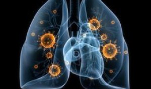 Investigadores de EEUU descubren tres nuevos tipos de cáncer de pulmón