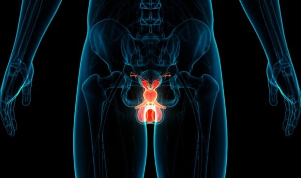 Investigadores descubren una nueva taxonomía del cáncer de próstata