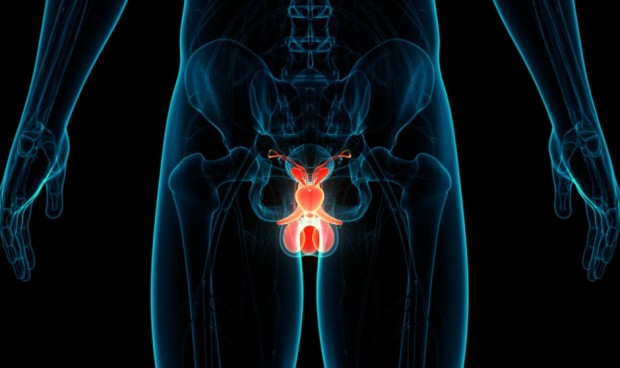 Investigadores descubren una nueva taxonomía del cáncer de próstata