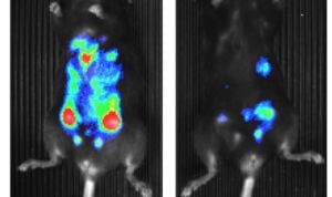 Investigadores españoles identifican una proteína que promueve los tumores