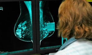 Imagen radiológica de mama