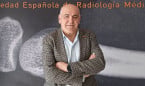 La ACE de Neurorradiología intervencionista da un paso clave