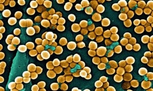 La actividad de la proteína FtsZ, blanco para descubrir nuevos antibióticos