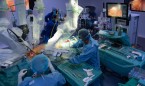La cirugía robótica será la primera opción para operar el cáncer de pulmón