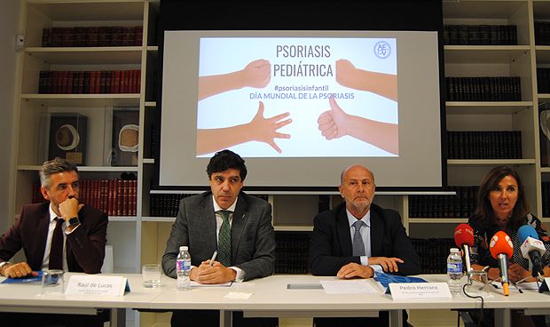 La confusión con el eccema retrasa el diagnóstico de la psoriasis en niños 