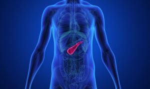 La duplicación de genes en el cáncer de páncreas potencia su agresividad