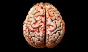La esperanza terapéutica contra el alzhéimer reduce el tamaño del cerebro