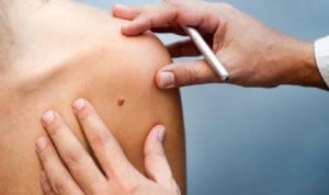 La incidencia del melanoma delgado es 15,8 veces mayor que la del grueso