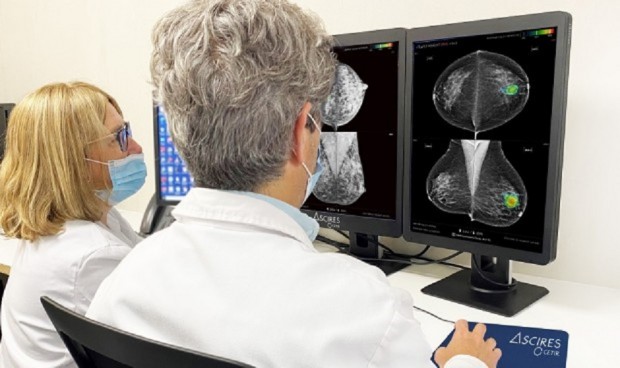 La inteligencia artificial "apoyo" del radiólogo al detectar cáncer de mama