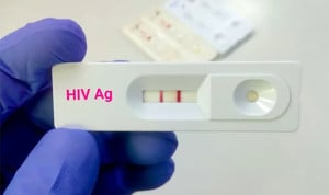 En 2023, se registraron 3.196 nuevas infecciones por VIH en España.