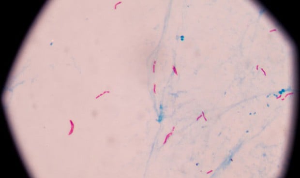 La necesidad de grasa, 'talón de Aquiles' de la bacteria de la tuberculosis